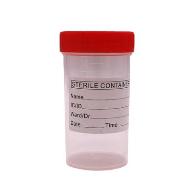Taza de recogida de heces de plástico de PP de 50 ml/60 ml para botella de muestra en materiales de laboratorio